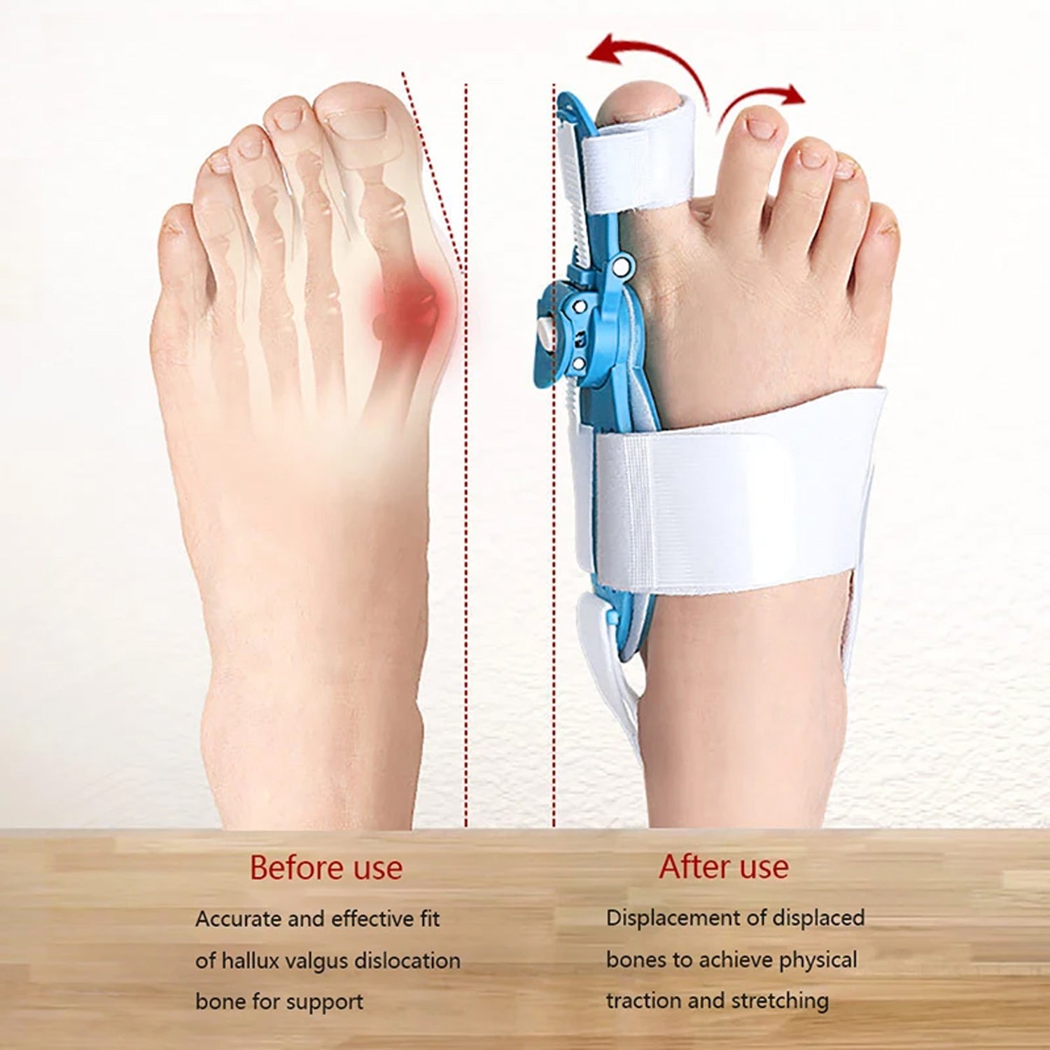 Adjustable Bunion Support Splint – Hallux Valgus Corrector for Men & Women Adjustable Bunion Support Splint – Hallux Valgus Corrector for Men & Women